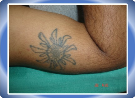 Tatoo