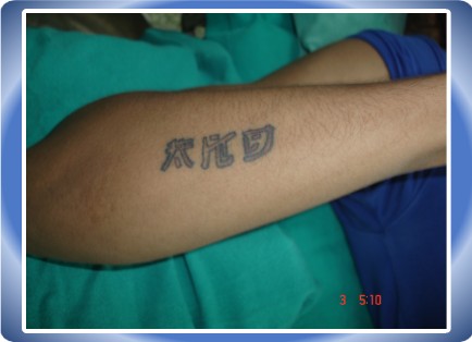 Tatoo